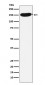 Anti-CPS1 Monoclonal Antibody